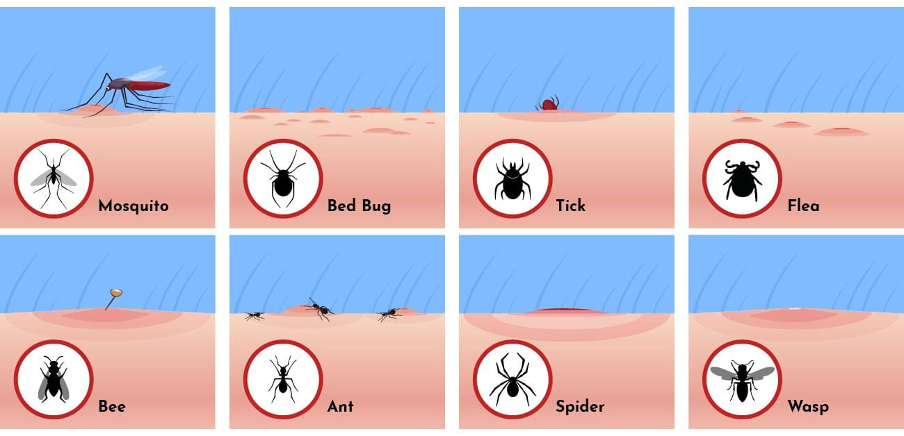 bed-bugs-mosquito-bee-differences bed-bugs-mosquito-bee-differences